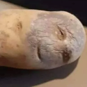 PotatoFungus